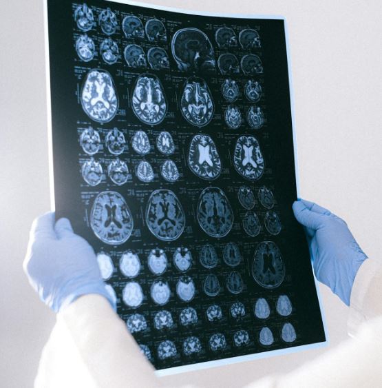 useful description of image if informative and not decoration only.